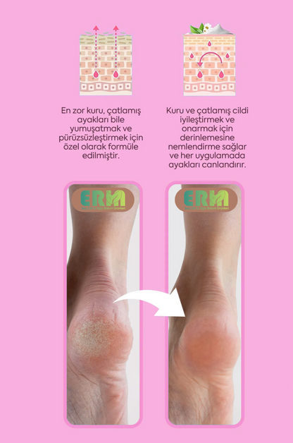 Onarıcı Ve Yumuşatıcı Ayak Bakım Kremi 100 ml